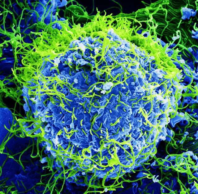Electron micrograph of Ebola virus particles