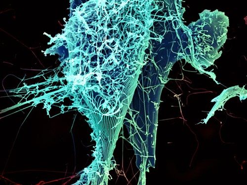 Microscope image of Ebola virus particles