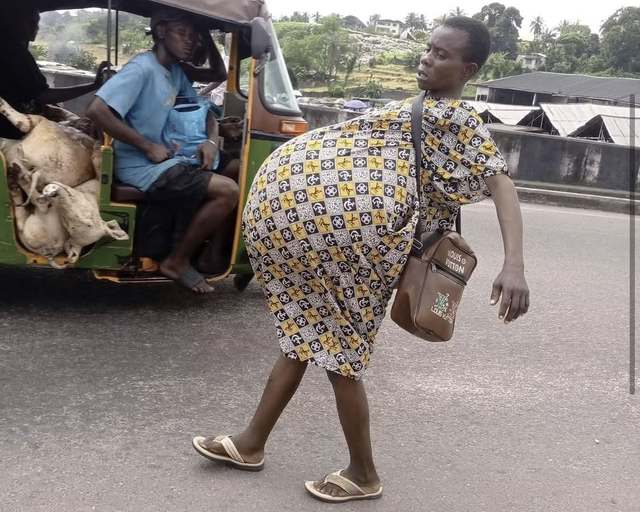 A woman in a yellow and black print dress, her body visibly swollen, crosses a road beside a tricycle